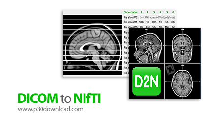 دانلود DICOM to NIfTI v1.11.0 - نرم افزار تبدیل تصاویر پزشکی DICOM به فرمت داده ای NIfTI