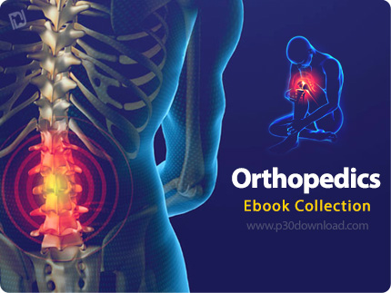 دانلود Orthopedics Ebook Collection - مجموعه کتاب های پزشکی ارتوپدی