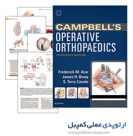 دانلود کتاب ارتوپدی عملی کمپبل ویرایش 2017 - Campbell's Operative Orthopaedics 13th