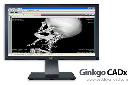 دانلود Ginkgo CADx Pro v3.6.0.1228.63 - نرم افزار نمایش، تجزیه و تحلیل و تبدیل تصاویر DICOM