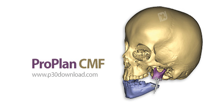 دانلود Materialise ProPlan CMF v3.0.1 x64 - برنامه ریزی مجازی برای جراحی CMF