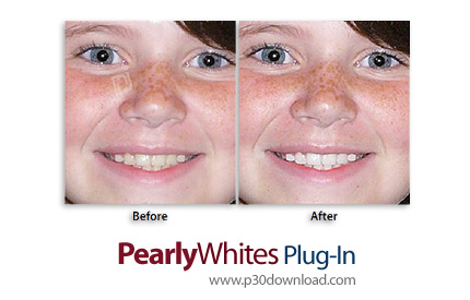 دانلود Imadio PearlyWhites Photoshop Plug-In v3.0.1 - پلاگین سفید کردن دندان ها به صورت خودکار در فت