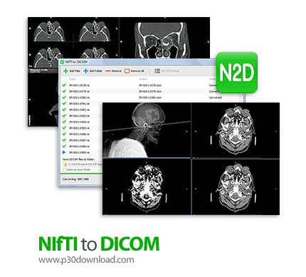 دانلود NIfTI to DICOM v1.11.0 - نرم افزار تبدیل فایل های NIfTI به DICOM