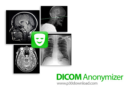 دانلود DICOM Anonymizer v1.11.0 - نرم افزار کد گذاری داده های پزشکی در فایل های DICOM