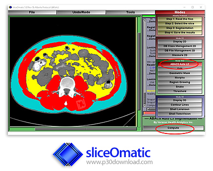 دانلود Tomovision sliceOmatic v5.0 Rev-9 x64 - نرم افزار تجزیه و تحلیل تصاویر پزشکی