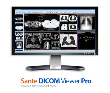 دانلود Sante DICOM Viewer 3D Pro v4.9.4 + Sante DICOM Viewer Pro v12.2.5 - نرم افزار نمایش تصاویر پز