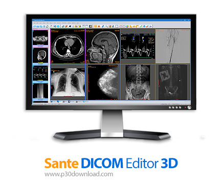 دانلود Sante DICOM Editor 3D v4.9.4 + Sante DICOM Editor v10.0.8 - نرم افزار ویرایش تصاویر پزشکی دیک