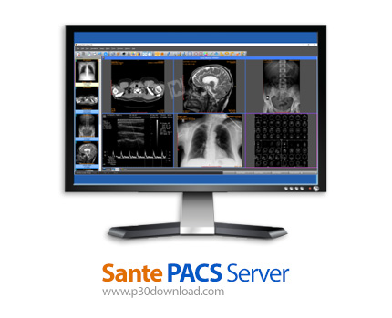 دانلود Sante PACS Server PG v3.2 - نرم افزار ذخیره سازی، بایگانی و مدیریت تصاویر پزشکی دیکام