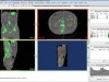 Mimics Innovation Suite Medical / Research Screenshot 1