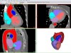 Mimics Innovation Suite Medical / Research Screenshot 2