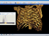 Sante DICOM Editor 3D Screenshot 5