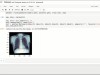Udemy Deep Learning with PyTorch for Medical Image Analysis Screenshot 2