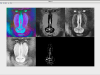 Fundamentals of Computer Vision Screenshot 2