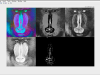 Fundamentals of Computer Vision Screenshot 4